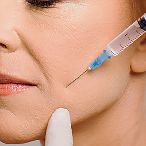 Treat Sunken Cheeks with our Juvéderm® at SF Bay Cosmetic Surgery Medical Group in San Ramon