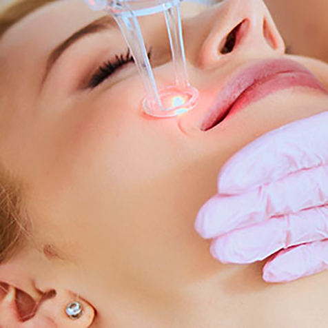 Treat Scarring with our UltraPulse® CO2 at SF Bay Cosmetic Surgery Medical Group in San Ramon