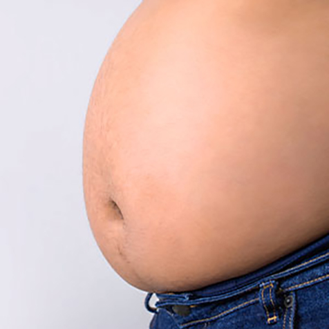 Beer Belly treatment options at SF Bay Cosmetic Surgery Medical Group in San Ramon, Pleasanton, San Jose, and Oakland