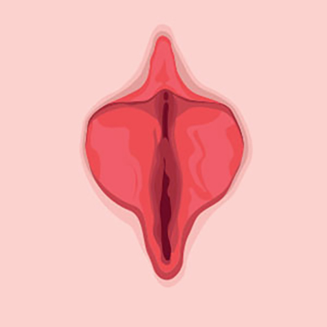 Image of patient struggling with Labiaplasty