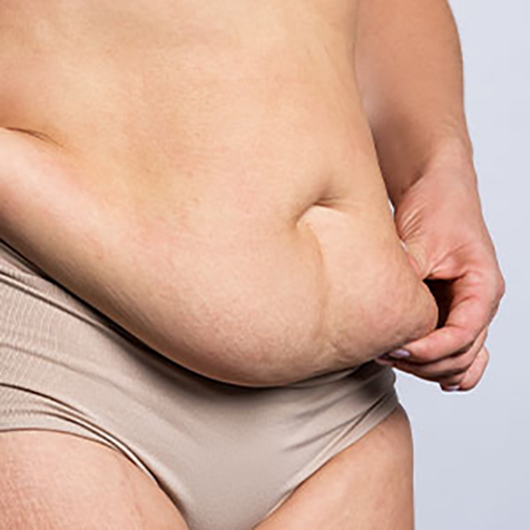 Image of patient struggling with Muffin Top