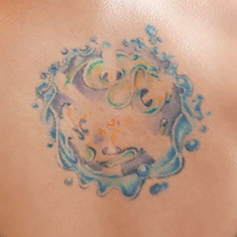 Unwanted Tattoo treatment options at SF Bay Cosmetic Surgery Medical Group in San Ramon, Pleasanton, San Jose, and Oakland