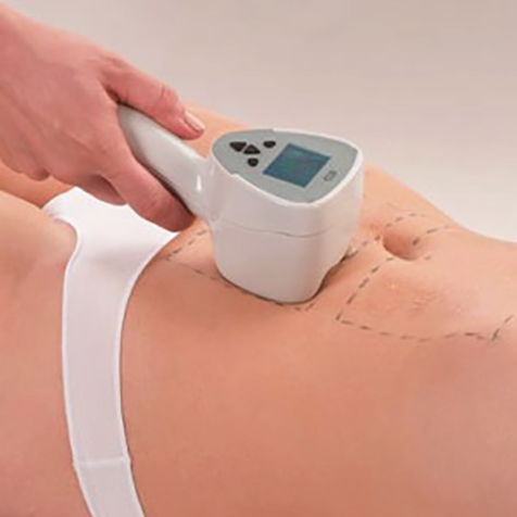 Treat Muffin Top with our Exilis Ultra 360™ at SF Bay Cosmetic Surgery Medical Group in San Ramon
