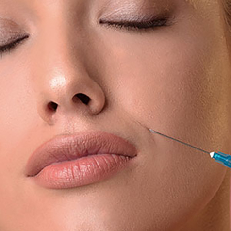 Treat Wrinkles with our Belotero Balance® at SF Bay Cosmetic Surgery Medical Group in San Ramon