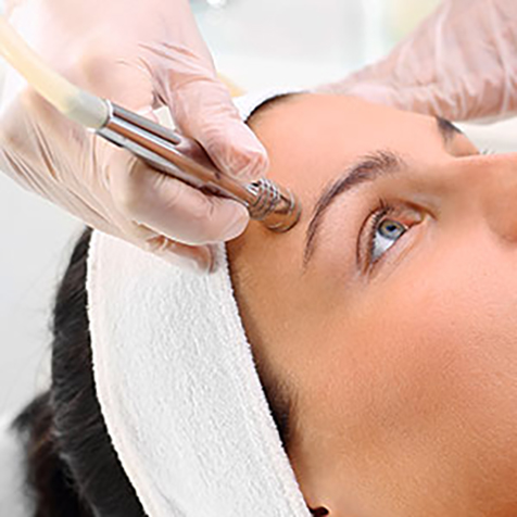Image of patient being treated with Microdermabrasion