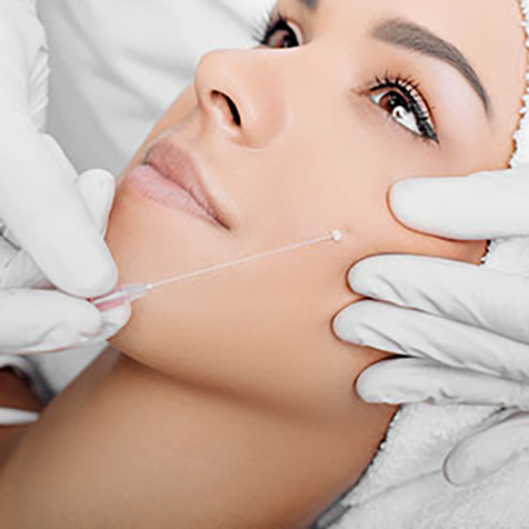 Treat Fine Lines with our PDO Thread Facelift at SF Bay Cosmetic Surgery Medical Group in San Ramon, Pleasanton, San Jose, and Oakland