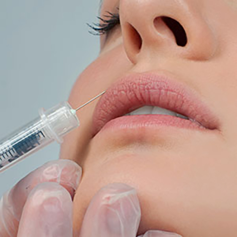 Treat Thin Lips with our Restylane® at SF Bay Cosmetic Surgery Medical Group in San Ramon