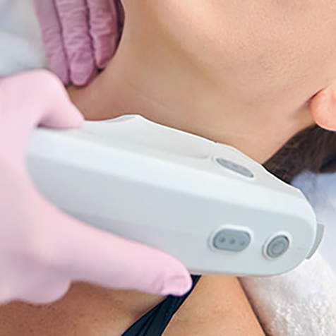 Image of patient being treated with Ultherapy®